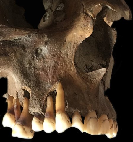 Piipu suitsetanud hollandlase hambad 17. sajandist. Teadlased eraldasid herpese DNA tema hambajuurtest.