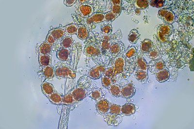 Зелёная нитчатая водоросль трентеполия (Trentepohlia umbrina) под микроскопом, по-эстонски – niitjas rohevetikas Trentepohlia.  Диаметр одной округлой клетки трентеполии около 20 мкм (0,02 мм)