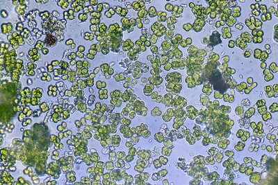 Зелёная водоросль плеврококк под микроскопом