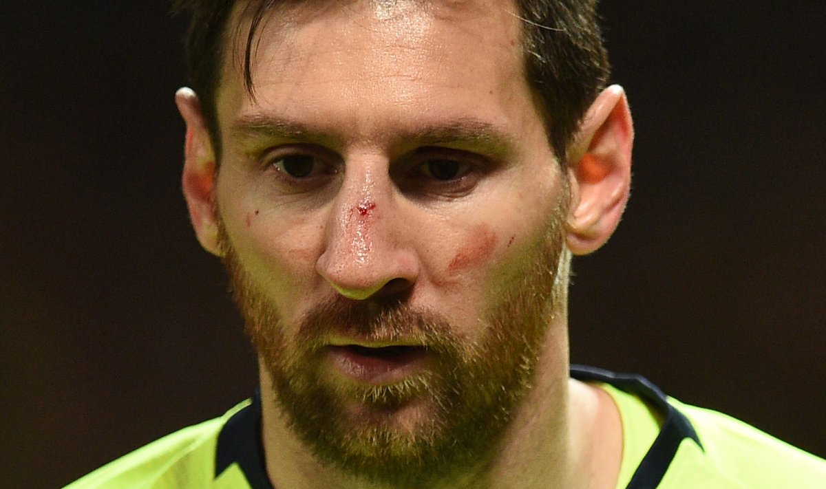 United suutis Lionel Messil küll nina veriseks lüüa, kuid Barcelona lahkus Manchesterist siiski võiduga.