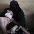 2011. aasta maailma pressifoto auhinna võitis foto Jeemeni naisest