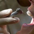 Hambaarst: on päris tavaline, et tarkusehammas ei mahu hästi oma kohale ära või kasvab viltu