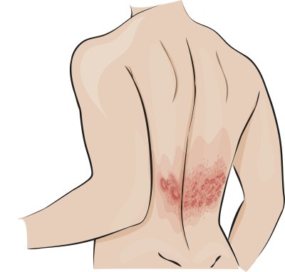 Foto: Shutterstock