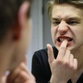 Sajad hambad ja lõualuud: hambaarsti sõnul levib tõukerattaõnnetuste tõttu hammastest ilmajäämine nagu pandeemia