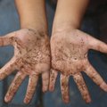 JAHMATAV KAADER | Inimesi hullutav Instagrami foto näitab, kui palju baktereid su lapse kätt reaalsuses katab