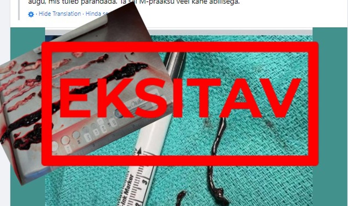 Pildid nii Eesti kui ka USA sotsiaalmeediast eksitavad lugejaid - pole tõestust, et need oleks vereklombid või seotud vaktsiinidega