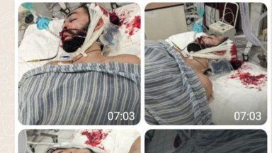 Õiglus on siiski olemas? Hukkus ukrainlase pealuuga hoobelnud vene marurahvuslane Igor Mangušev
