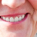 Hambaarst selgitab: kuidas kaitsta hambaid jahedate ilmadega