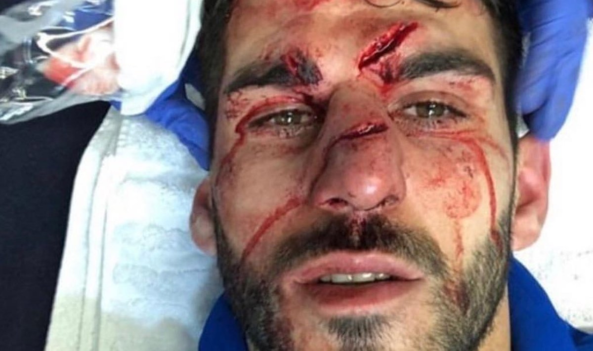 Nelson Oliveira