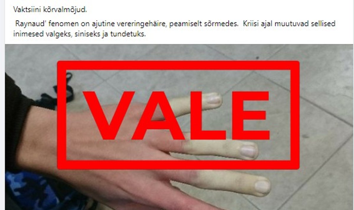 Ei ole leitudühtegi seost Raynaud'i fenomeni ja vaktsiinide vahel