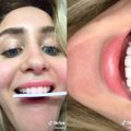 VIDEOD | TikTokis levib üks hammastega seotud väga halb trend, mille eest lapsevanemad oma teismelisi lapsi hoiatama peaksid