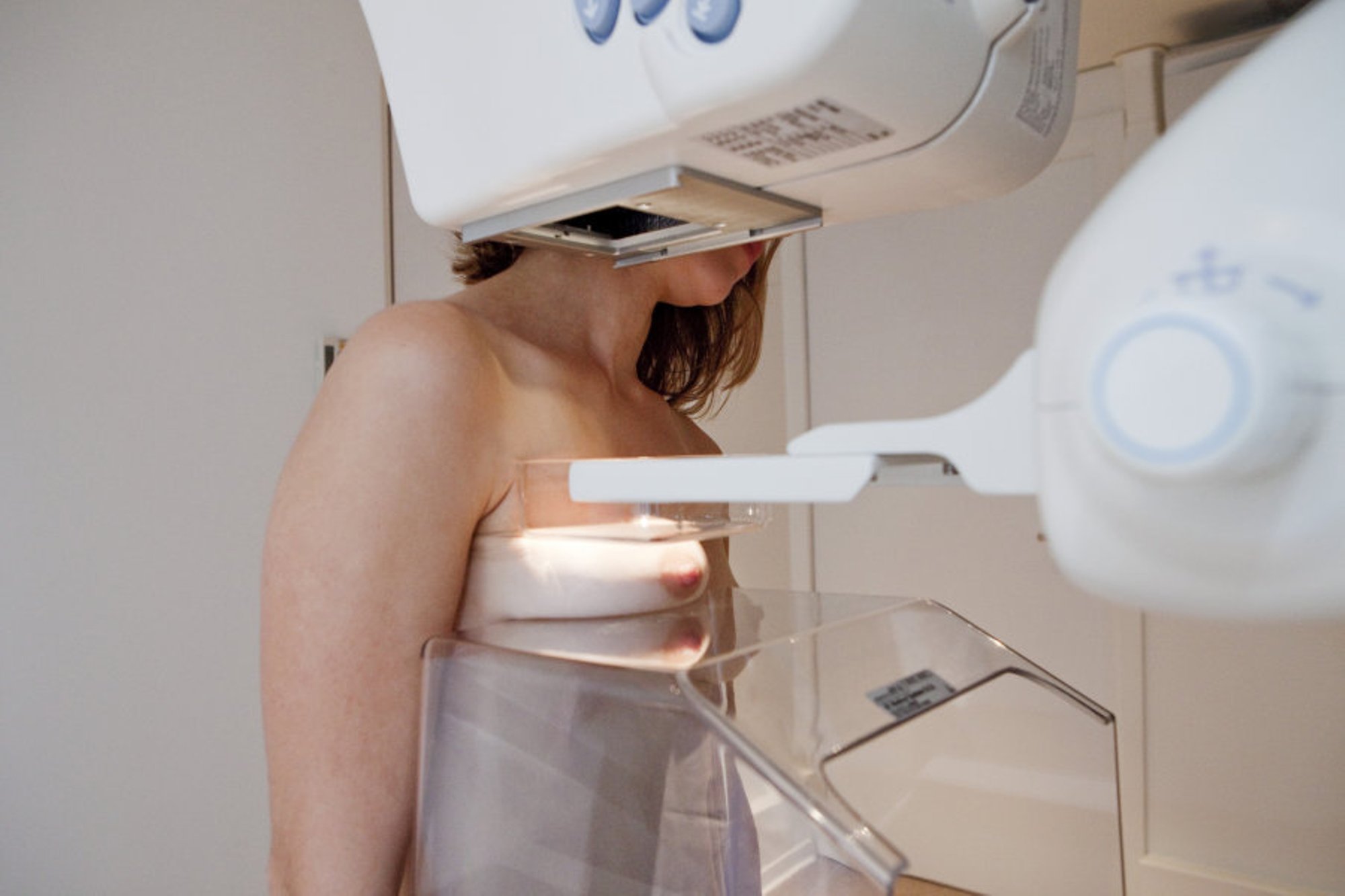 как делают маммографию груди у женщин фото 7