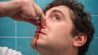 Arst selgitab: raskekujulist ninaverejooksu on kodustes tingimustes ülikeeruline peatada. Millal on vaja kutsuda kiirabi?