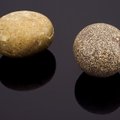 Nelja sorti kivid, mida inimkehast leida võib