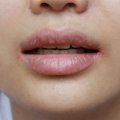 Mis juhtub su huultega, kui kasutad liiga sageli huulepalsamit? Ja maksimaalselt kui tihti seda siis teha tohib?
