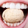 Hambaarstid hoiatavad: need kaheksa toitu mõjuvad suuhügieenile kohutavalt