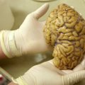 Tehnikaülikooli teadlaste osalusel tehtud uurimus on lähedal läbimurdele Parkinsoni tõve ravis