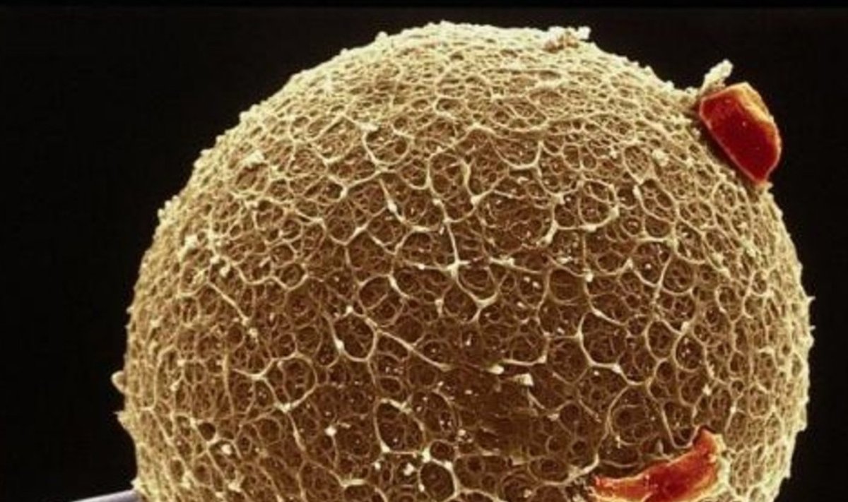 Tehismunasarjad vähendaksid võimalust vähi naasmiseks. (Foto: Y. Nikas / Wellcome Images)