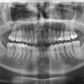 VASTUKAJA | Hambaarst Kristjan Gutmann: hambahaigused on käitumishaigused, riik hüvitagu vaid tervisehäda puhul