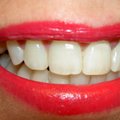 ARST SOOVITAB | Mida süüa, et hoida hambad tervena?