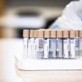 За сутки в Эстонии выявлено 2104 случая заражения коронавирусом, умерли пять человек