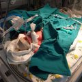 27. rasedusnädalal sündinud beebi ema: ta sünnikaaluks ennustati 600 g, mu maailm varises kokku ja iga tund oli arvel