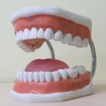 Hambatraumad: mis need täpsemalt on ja kuidas aru saada, millega on tegu?