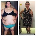 FOTOD | Selle 23aastase naise ausad fotod näitavad, mida 80 kilo kaotamine tegelikult tähendab