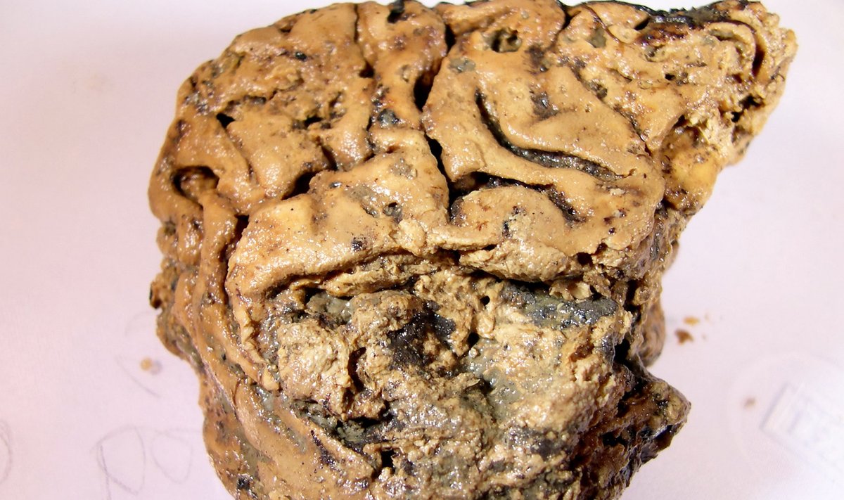 Heslingtoni aju on vähemalt 2600 aasta vanune