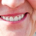 Hambaarst selgitab: kuidas kaitsta hambaid jahedate ilmadega