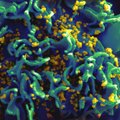 Teadlastel õnnestus HIV-i levimist kehas vahetult jäädvustada