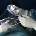 Ohtlikke rinnaimplantaate on Eestis paigaldatud 364 patsiendile