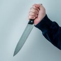 ФОТО | Пьяный мужчина ударил свою собаку ножом