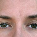 Kui su silmad on kogu aeg väsinud, siis proovi neid tõhusaid harjutusi, et silmalihaseid tugevdada