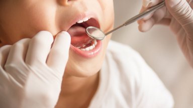 Väikelaps kardab hambaarsti? Nõuanded, et esimene visiit mööduks võimalikult stressivabalt
