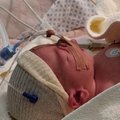Südamerikkega beebi ema: lamasin ultrahelis ja lootsin vaid, et arstid vaatavad valesti, et temaga on tegelikult kõik hästi
