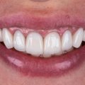Hambaarst avaldab, miks ikkagi peab kord aastas kindlasti hambaarsti juures käima