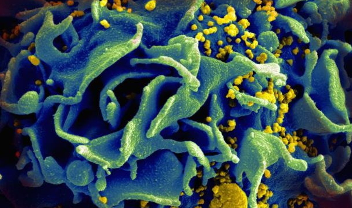 HIV-iga nakatunud T-rakk