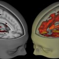 Teadlased uurisid LSD mõjusid esmakordselt ajuskanneritega