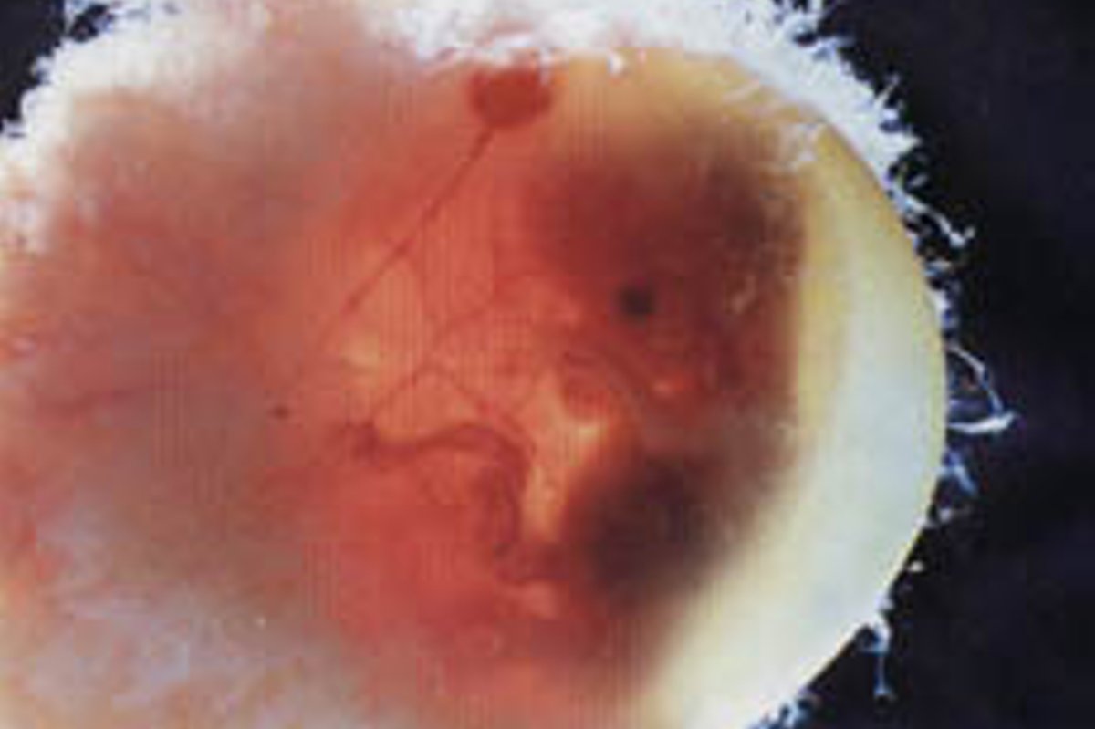 Эмбрион это сгусток клеток