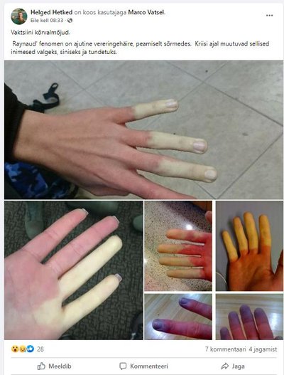 Piltidel kujutatud haiguse ja vaktsiinide vahel pole tegelikult mingit seost tuvastatud.